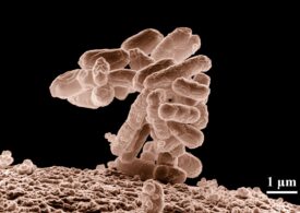O bacterie care "mănâncă" metal a fost descoperită din întâmplare de cercetători