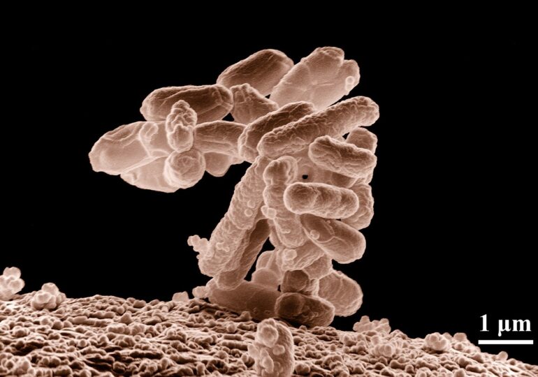 O bacterie care "mănâncă" metal a fost descoperită din întâmplare de cercetători