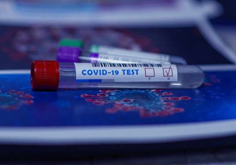 Lista centrelor de testare COVID-19 a fost publicată