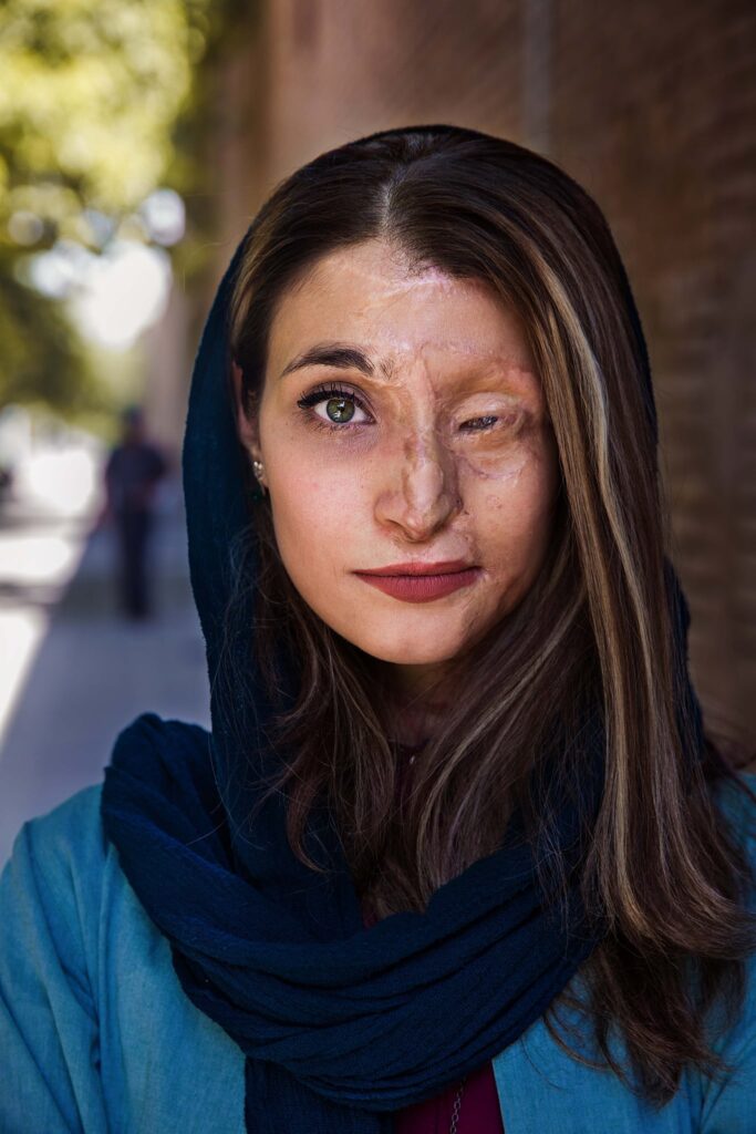 marzieh-femeie-iran-arsa-acid-fotografii-mihaela-n