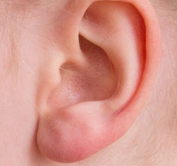 Primul pacient care și-a pierdut auzul din cauza COVID-19