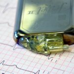 Magneții din telefoane sau ceasuri smart pot afecta  stimulatoarele cardiace. Recomandările FDA