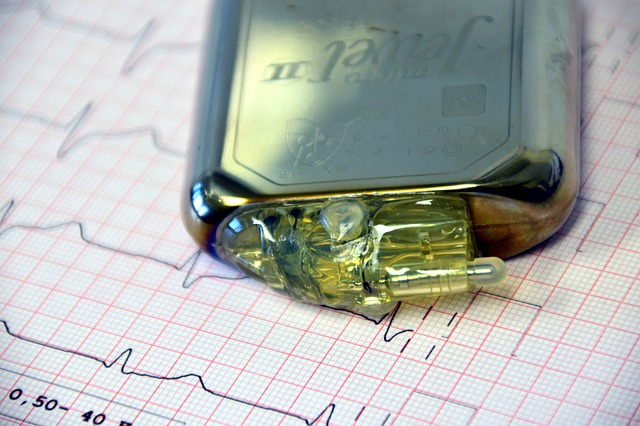 Magneții din telefoane sau ceasuri smart pot afecta  stimulatoarele cardiace. Recomandările FDA