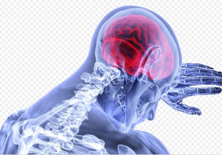 Harta tulburărilor neurologice suferite de pacienții Covid: de la accident vascular cerebral la cefalee