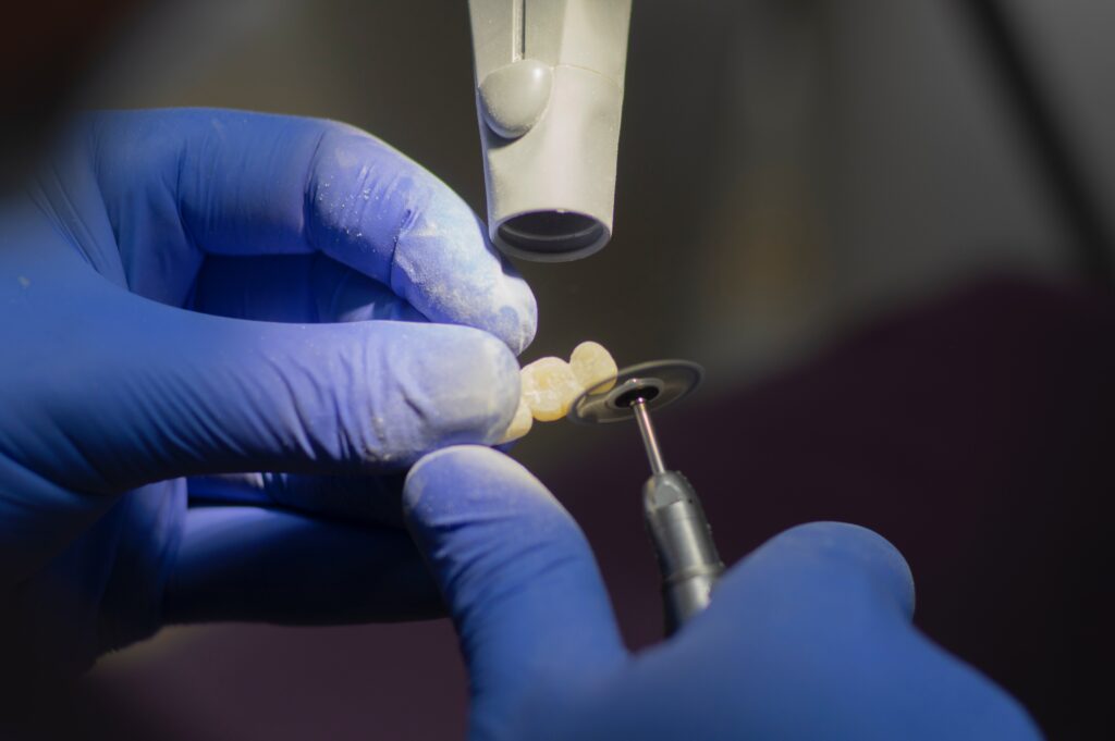 Implant-Dentar-CabinetStomatologicsector2