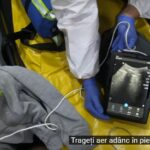 Un medic de la SMURD ne arată complicațiile Covid la un pacient sănătos, de circa 30 de ani (VIDEO)