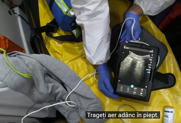 Un medic de la SMURD ne arată complicațiile Covid la un pacient sănătos, de circa 30 de ani (VIDEO)