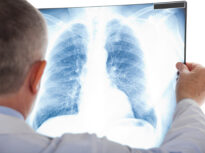 La ce mai e bună inteligența artificială: De la protejarea pacienților care fac o radiografie până la prezicerea cutremurelor