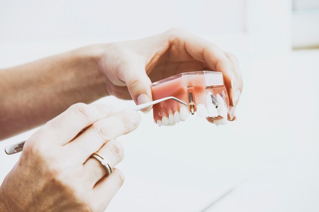 Află care sunt 4 dintre cele mai comune mituri despre implantul dentar