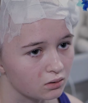 O fată de 13 ani din Ucraina a supravieţuit miraculos, după ce o bucată de șrapnel i s-a înfipt în creier