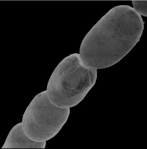 A fost descoperită cea mai mare bacterie din lume. E un Everest printre suratele sale