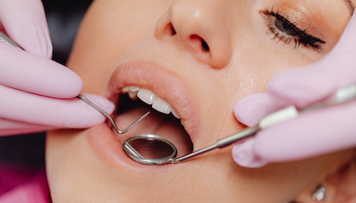Estetica dentară: 6 proceduri pentru un zâmbet de invidiat