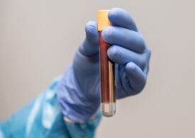 Premieră medicală: Transfuzie cu sânge creat în laborator
