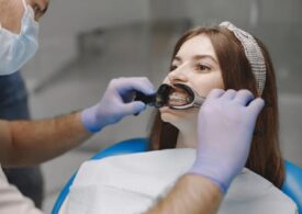 Cum alegi un aparat dentar potrivit problemelor tale, 5 recomandări