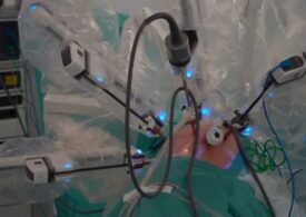 Premieră mondială în transplantul pulmonar, cu ajutorul robotului Da Vinci (Video)