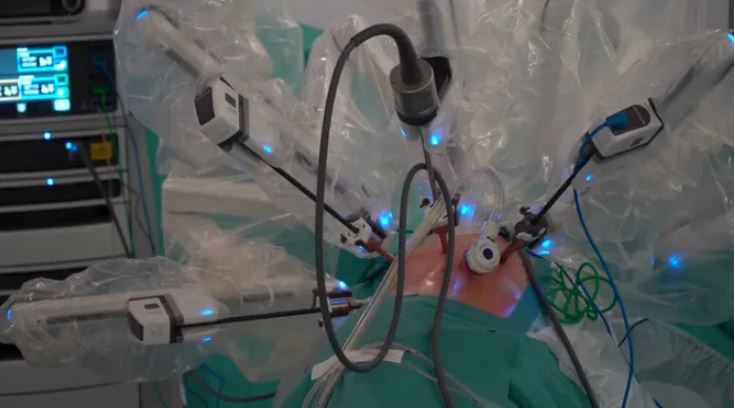 Premieră mondială în transplantul pulmonar, cu ajutorul robotului Da Vinci (Video)