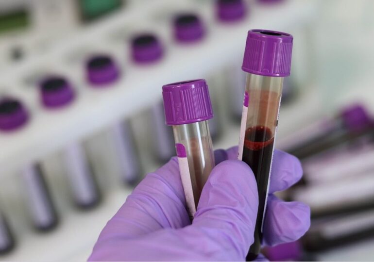 Teste de sânge care arată dacă vei face diabet în următorii 10 ani