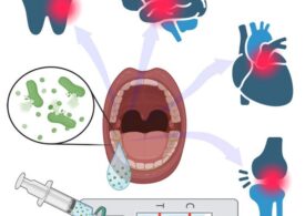 Test la domiciliu pentru diagnosticarea gingivitei