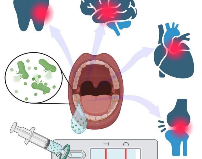 Test la domiciliu pentru diagnosticarea gingivitei