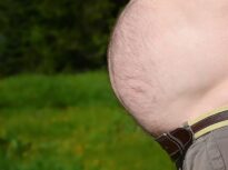 Medic: 40% dintre români suferă de obezitate. 3 din 4 au încercat măcar o dată în viață să țină o dietă. Cum ar trebui să arate „farfuria perfectă” la prânz