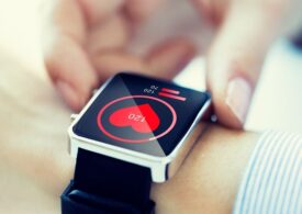 Importanța foliei de protecție pentru prevenirea zgârieturilor pe smartwatch