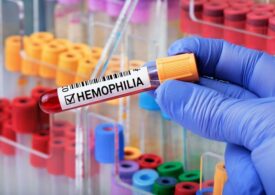 Hemofilia: simptome și cauze