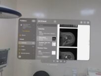 Inovație tech: Cum ajută casca Vision Pro un medic în timpul operației