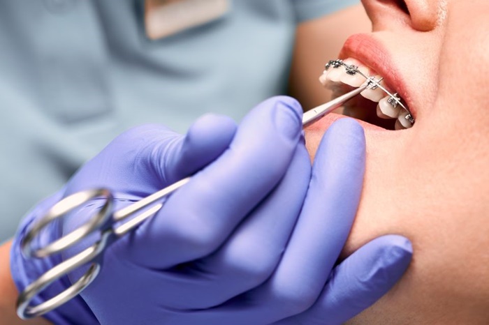 Cum îți poate îmbunătăți ortodonția sănătatea orală și calitatea vieții