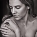 Fabrica de piele care lucrează non-stop pentru supraviețuitorii infernului de la Crans-Montana: Din 10 cm de piele se face un spate întreg