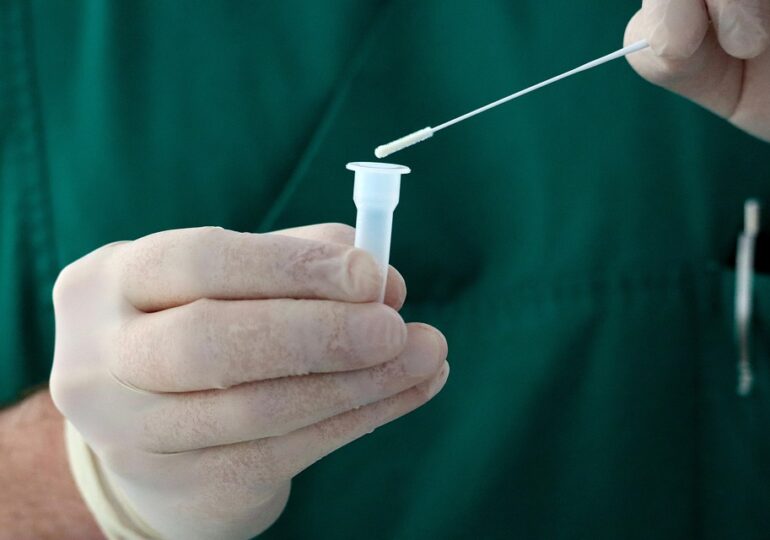 Test ieftin și rapid de salivă pentru cancerul de prostată