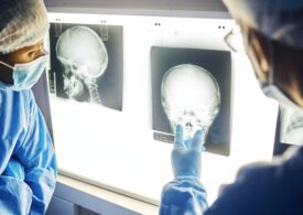 Unde poți face în București o radiografie, un CT sau un RMN