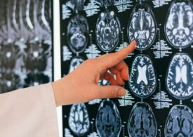 Oamenii de știință au modificat LSD-ul și au creat un nou medicament pentru creier