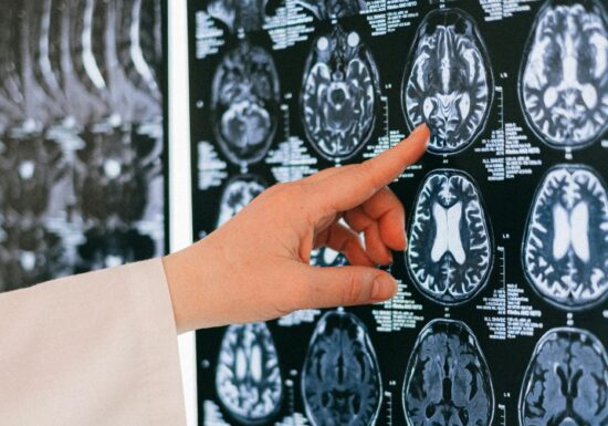 Oamenii de știință au modificat LSD-ul și au creat un nou medicament pentru creier
