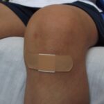 Rănile umane se vindecă de aproape trei ori mai lent decât la animale, iar acum oamenii de știință au descoperit și de ce