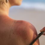 Cel mai bun mod de a evita arsurile de piele provocate de UV nu este crema de protecție solară
