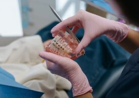 Cum știi că ai nevoie de aparat dentar? 3 semne