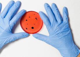Antibioticele nu ne mai salvează: Superbacteriile pun în pericol milioane de vieți și ne vor costa trilioane de dolari