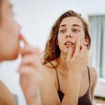 INTERVIU „Cancerul de piele la debut poate îmbrăca aspecte variate, nespecifice. Alunițele nu sunt singurele semne.“ Ghid complet de simptome și tratament