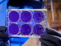 Superbugs could kill millions of people by 2050. But it’s possible we may have the treatment for 100 years