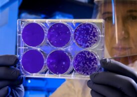 Superbacteriile ar putea ucide milioane de oameni până în 2050. Dar e posibil să avem de 100 de ani tratamentul