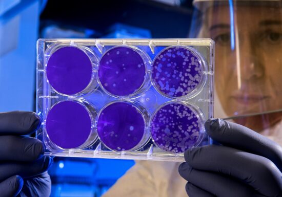 Superbacteriile ar putea ucide milioane de oameni până în 2050. Dar e posibil să avem de 100 de ani tratamentul