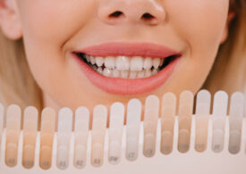 Secretele fatetelor dentare naturale: Tips and tricks