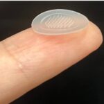 Nou tratament pentru acnee: plasturele cu microace. În cât timp vindecă