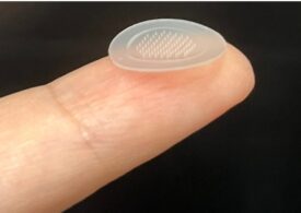 Nou tratament pentru acnee: plasturele cu microace. În cât timp vindecă