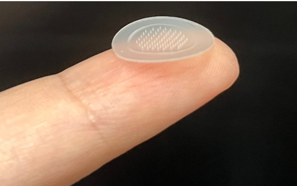 Nou tratament pentru acnee: plasturele cu microace. În cât timp vindecă