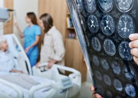 Minutul care poate salva o viață. Recunoaște primele semne ale unui AVC și acționează rapid