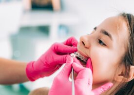 Proiectul Smile - Aparate dentare pentru elevii din București