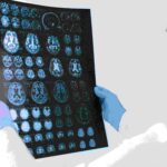 Traumele din copilărie duc la apariția unei substanțe în creier aflată în strânsă legătură cu depresia și nu numai