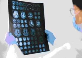 Traumele din copilărie duc la apariția unei substanțe în creier aflată în strânsă legătură cu depresia și nu numai