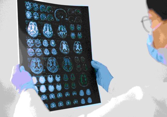 Traumele din copilărie duc la apariția unei substanțe în creier aflată în strânsă legătură cu depresia și nu numai